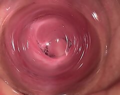 Cum medial my teen stepsister and show creampie deep medial pussy