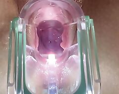 Stella St. Rose - Extreme Gaping, See my Cervix Close-Up no way a Speculum
