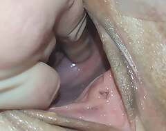 Cervix for Namsei (close-up)
