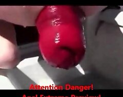 Experimental anal going knuckle deep